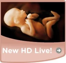 HD Live 4D baby scan Glasgow