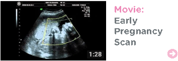 Early Pregnancy Scan 8 Weeks 