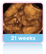 27 Week Pregnancy Scan