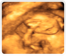 week 20 pregnancy ultrasound scan