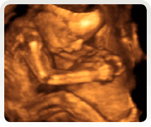week 22 4d ultrasound scan