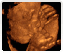 week 26 3d baby scan 