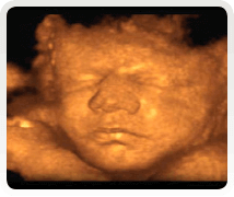 week 34 baby scan 