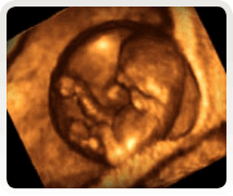 Week 10 Ultrasound scan