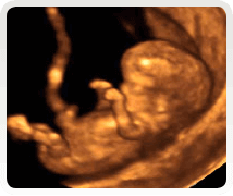 Week 12 4D Baby Scan