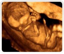 week 14 pregnancy scan 