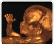 Week 15 3d ultrasound scan