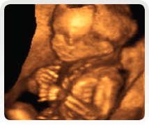 week 17 ultrasound scan 