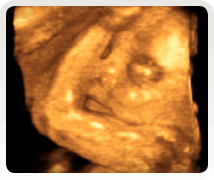 week 23 baby scan 