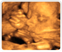 Week 24 4d baby scan 