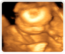 week 25 4d pregnancy scan