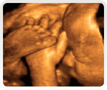 week 32 4d pregnancy scan 
