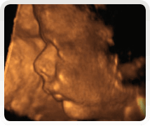 37 week pregnancy scan